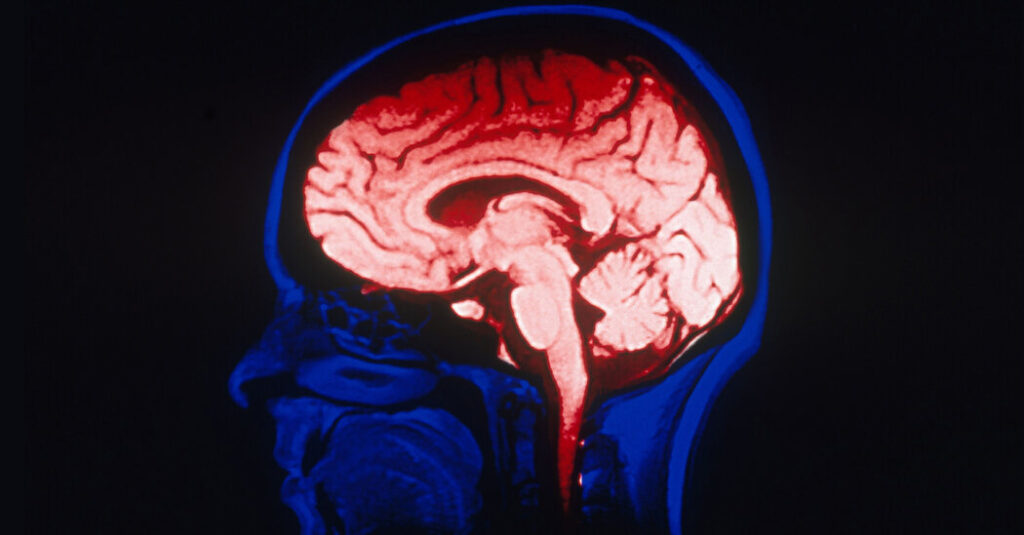 brain imaging studies hampered by small data sets study finds